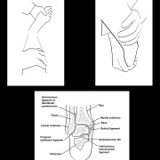 Custom Drawings – Ankle Exam for Stress Fracture and Anatomy